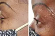 Sacred Womb and Body Renewal, Sacred Renewal Face & Neck Tighten, or Fibroblast for Crows Feet - Second Medium