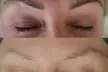 Eyebrow Tattoo Removal: Save Up to 30% Off at MB Advanced Beauty MED SPA! - Second Medium