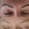 Image 3: Eyebrow Tattoo Removal: Save Up to 30% Off at MB Advanced Beauty MED!