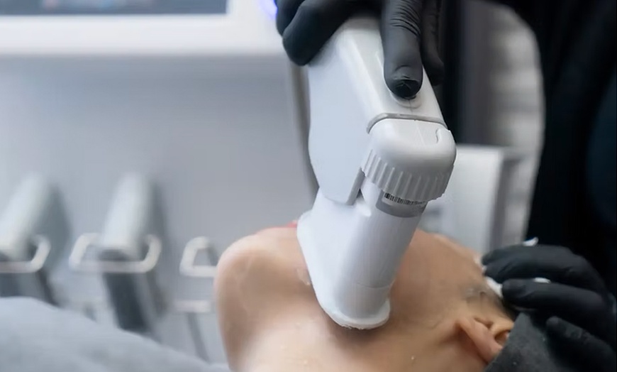 Image 2: One HIFU Facial Treatment On Full Face & Neck & Decolletage Area