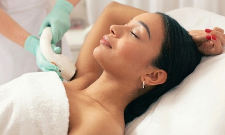 6 Laser Hair Removal Sessions on One Small Area - Every Body Health & Wellness