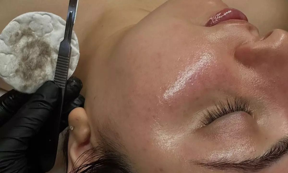 Chemical Peel, Dermaplanning Facial, Lip Blush Permanent Makeup & More