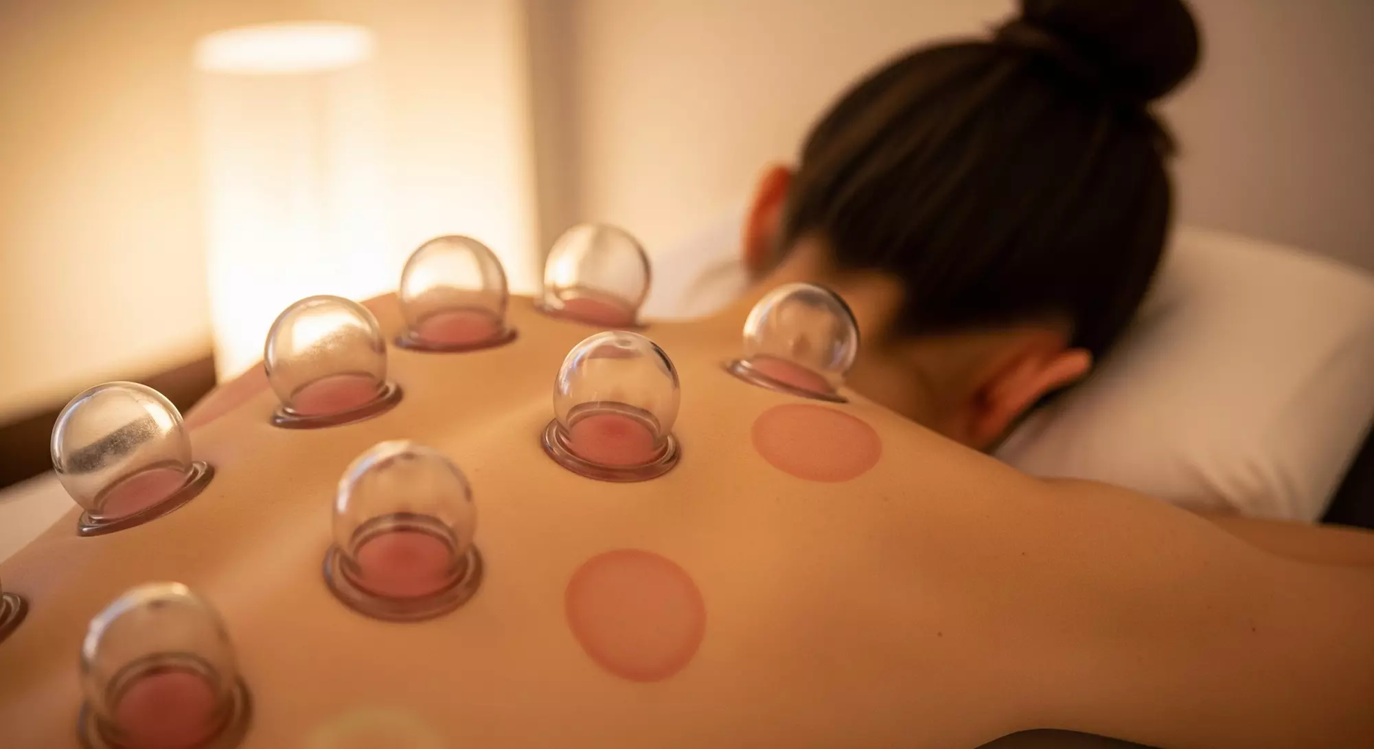 Up to 74% Off on Cupping at Natural Wellbeing - Primary Image