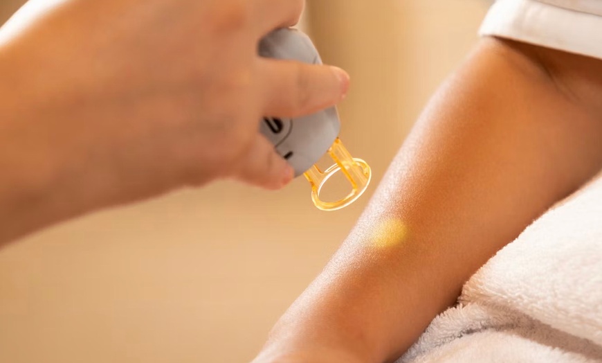 Image 3: Laser Hair Removal Sessions