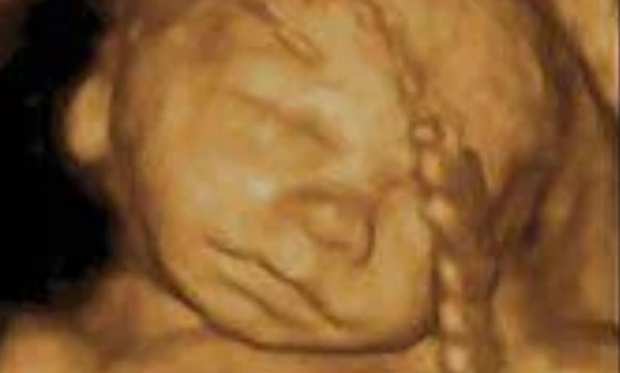 Image 4: See Your Baby In Amazing 3D/4D, 8K Ultrasound Clarity! 