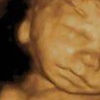 Image 4: See Your Baby In Amazing 3D/4D, 8K Ultrasound Clarity! 
