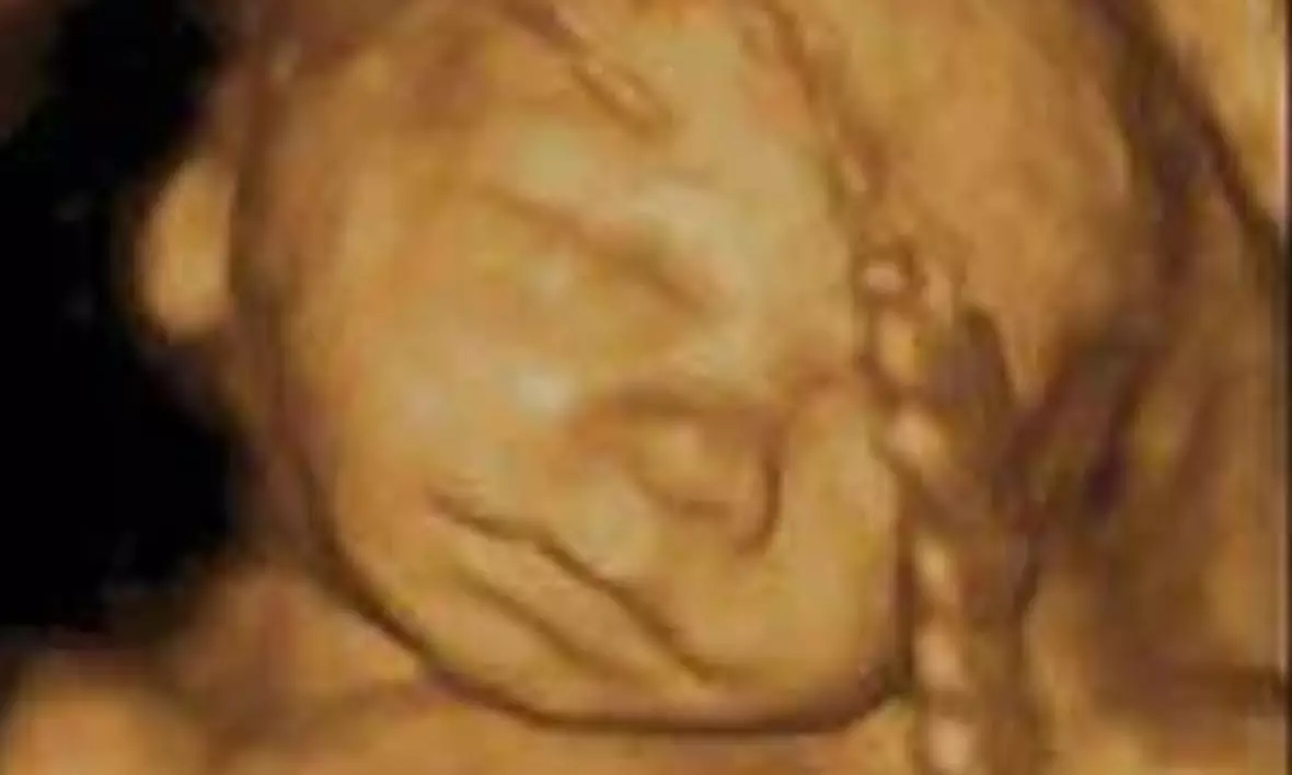 See Your Baby In Amazing 3D/4D, 8K Ultrasound Clarity! 