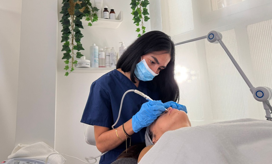 Image 2: 1 o 2 sesiones de 30 minutos de radiofrecuencia facial o corporal 