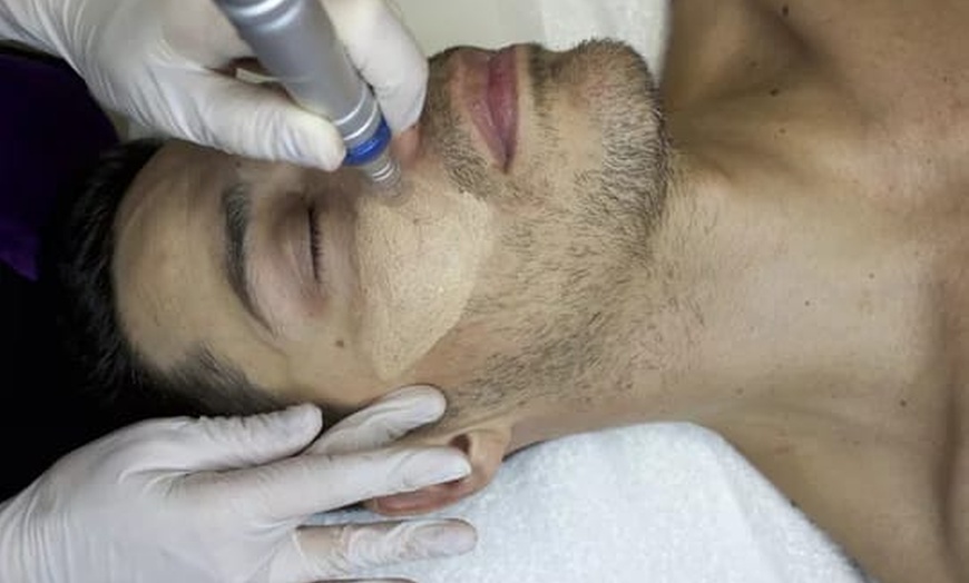 Image 3: 1 oder 2 BB-Glow- oder Microneedling-Behandlungen 