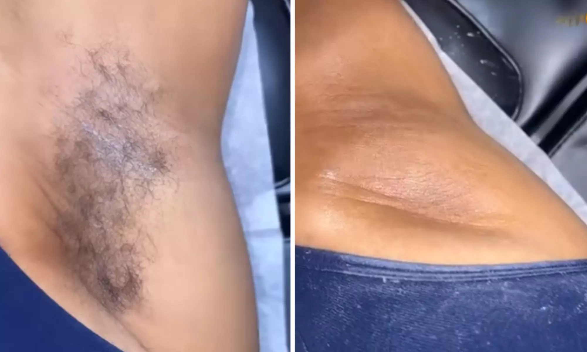 Get Silky Smooth with Woman’s Lower Leg, Under Arm, or Arm Wax