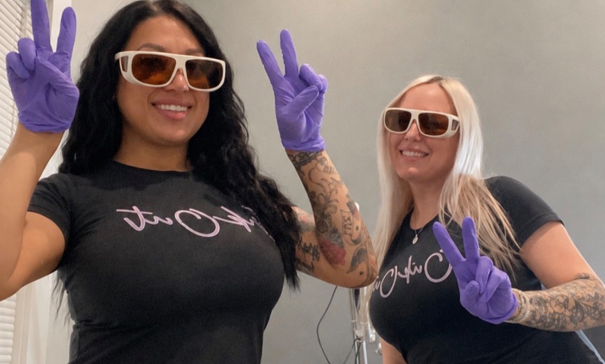 Image 3: Three Laser Tattoo Removal Sessions on an Area (1,3 or 6 Inches)