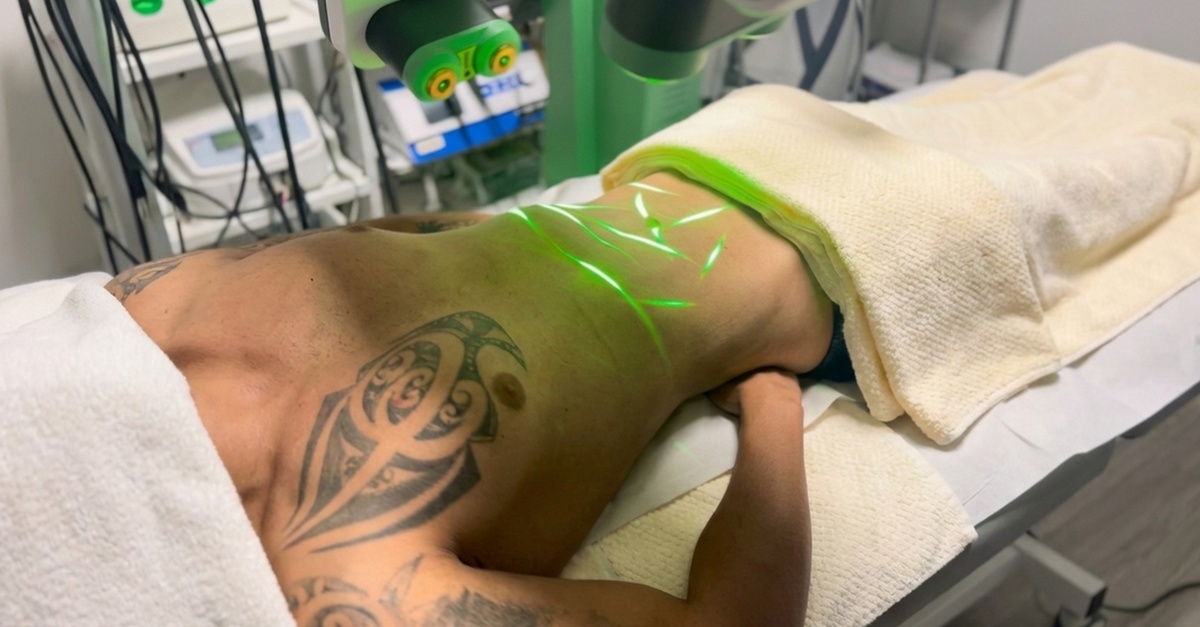 Tratamiento corporal con Emerald Láser en Madrid