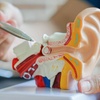 Image 2: Up to 35% Off on Microsuction Earwax Removal!
