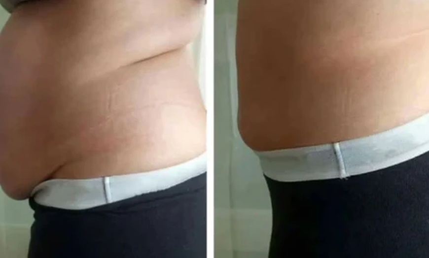 Image 4: Boost Recovery with Two, Four, Six, or Eight Cryotherapy Treatments