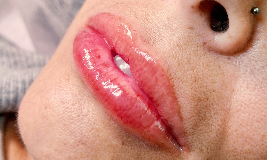 Image 2: Revitalize Your Lips with Hydra Gloss Lips or Glossyps