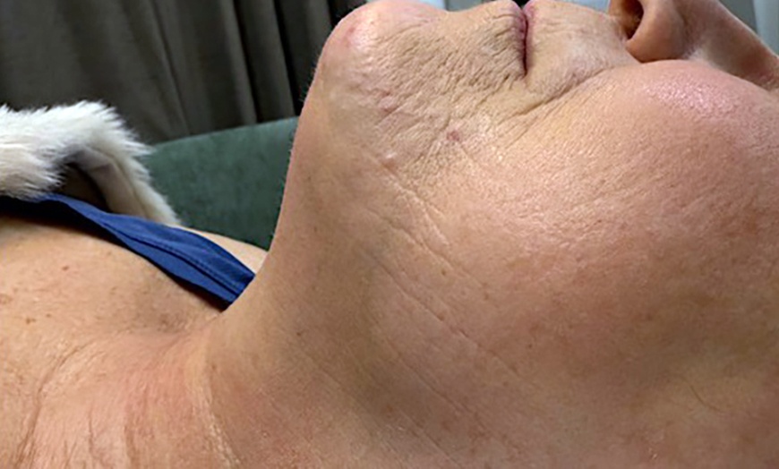 Image 6: Relax with Cryo & Thermal Body sculpting (2 or 3 sessions)