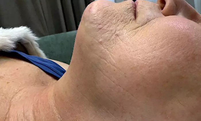 Relax with Cryo & Thermal Body sculpting (2 or 3 sessions)