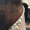 Image 5: Scalp Analysis and Hair Restoration Consultations
