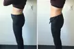 Slim, Sculpt & Glow — CryoSlimming + Cryo Glo Facial at Shape Lounge - Second Medium