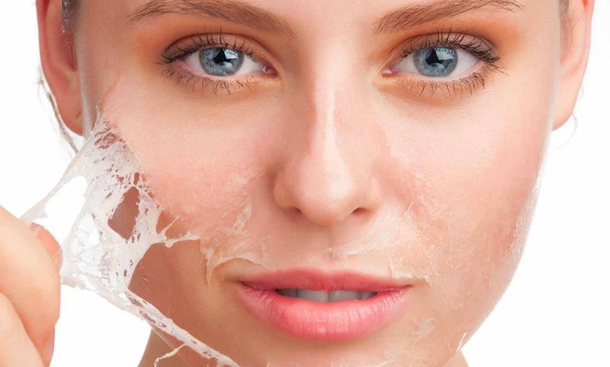 Image 2: Brighten Dull Skin with One or Two Custom Chemical Peels