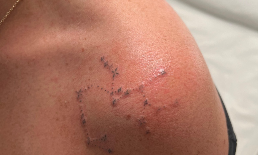 Image 4: Three or Six Sessions of Laser Tattoo Removal, Consultation, & Patch Test at Faded Laser Clinic (Up to 83% Off)