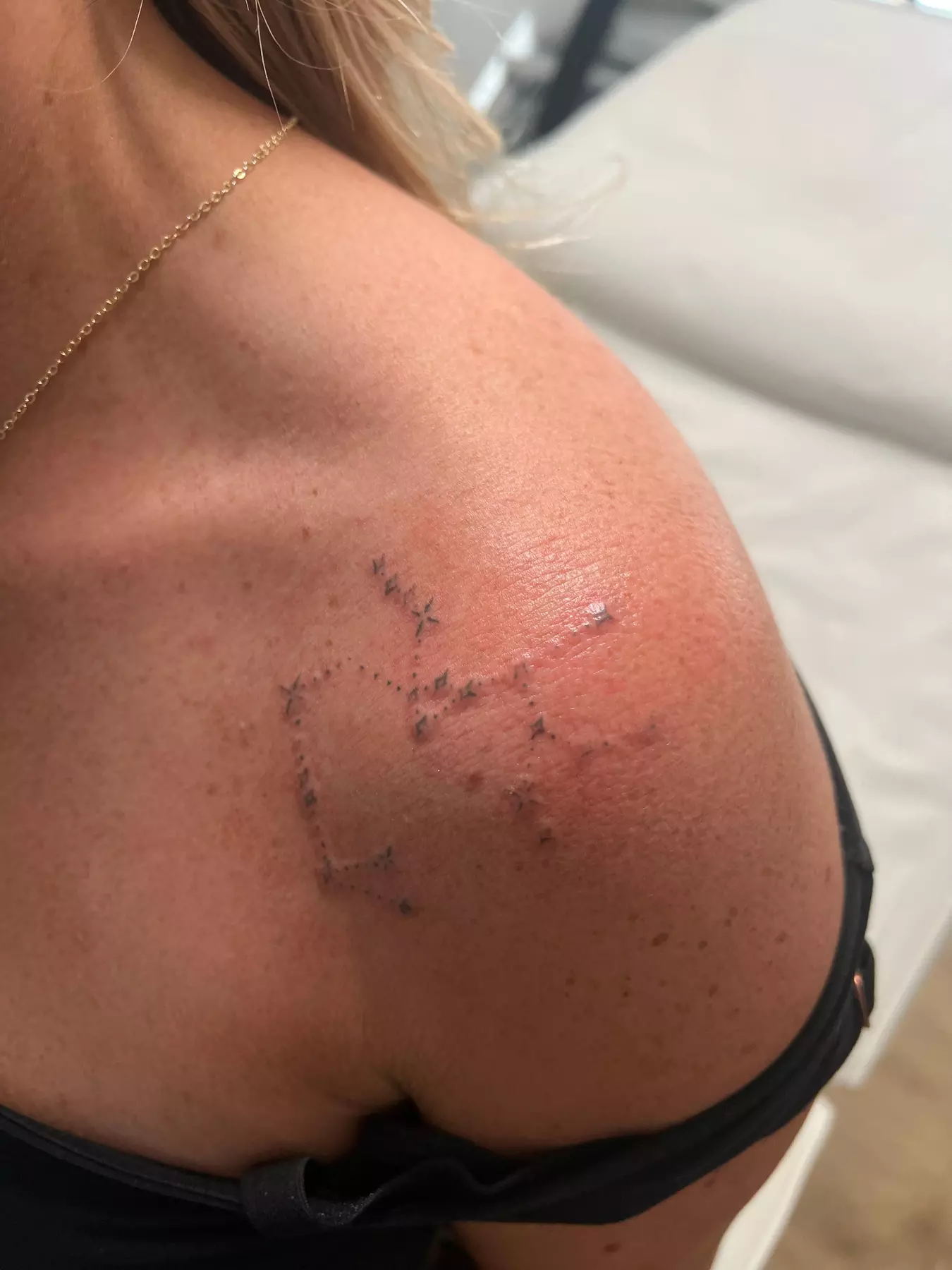 Three or Six Sessions of Laser Tattoo Removal, Consultation, & Patch Test at Faded Laser Clinic (Up to 83% Off)