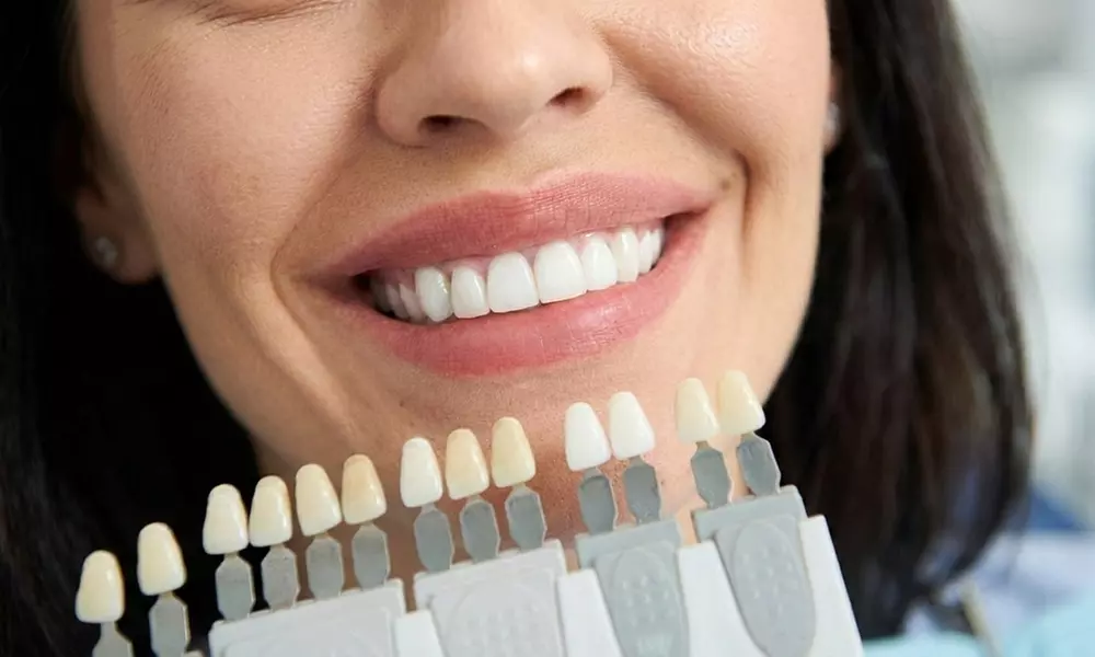 Kosmetisches Zahn-Bleaching und Microneedling für 1 Person