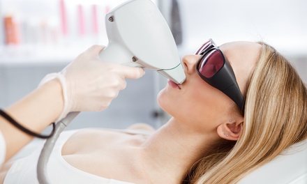 One Laser Hair-Removal Session on One Small Area - Lenoks Centre
