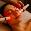 Image 3: Relax with One or Two Microneedling Sessions with LED Light Therapy