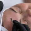 Image 2: Revitalize Your Skin with Dermaplane Facial