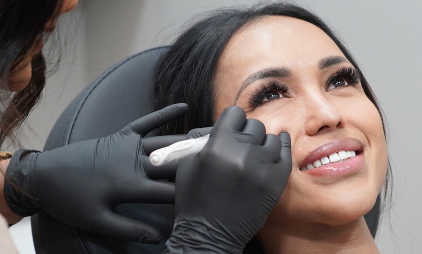 Image 7: Anti-Wrinkle Injections on One Major Area