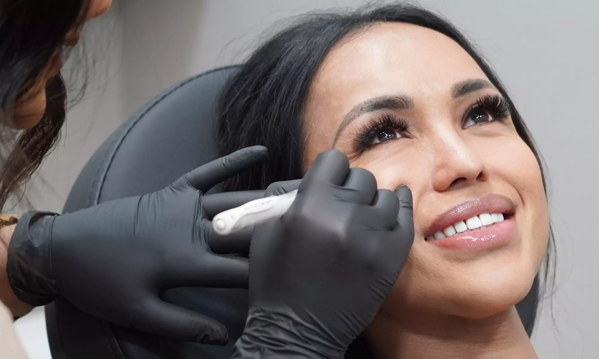 Anti-Wrinkle Injections on One Major Area