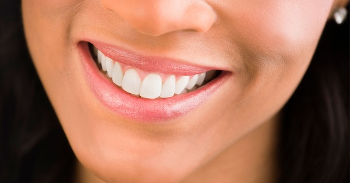 Limpieza bucal profesional con blanqueamiento dental LED en Sevilla