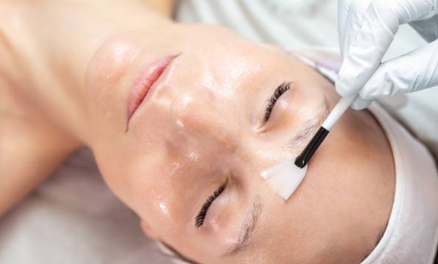 Image 8: Limpieza facial con tratamientos adicionales en opción para 1 persona 