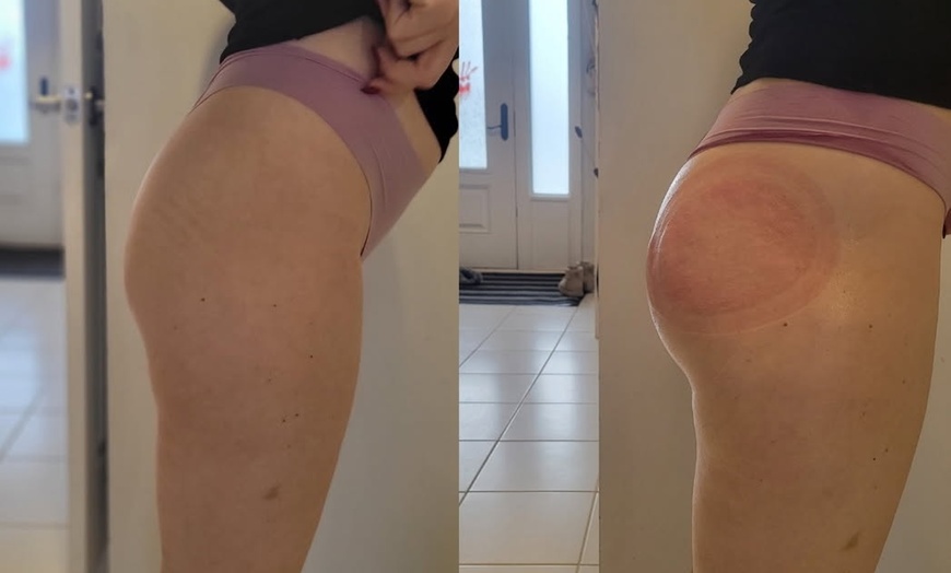 Image 9: 1, 2, or 3 Mini Mommy Make Over with Vacuum Therapy and More 