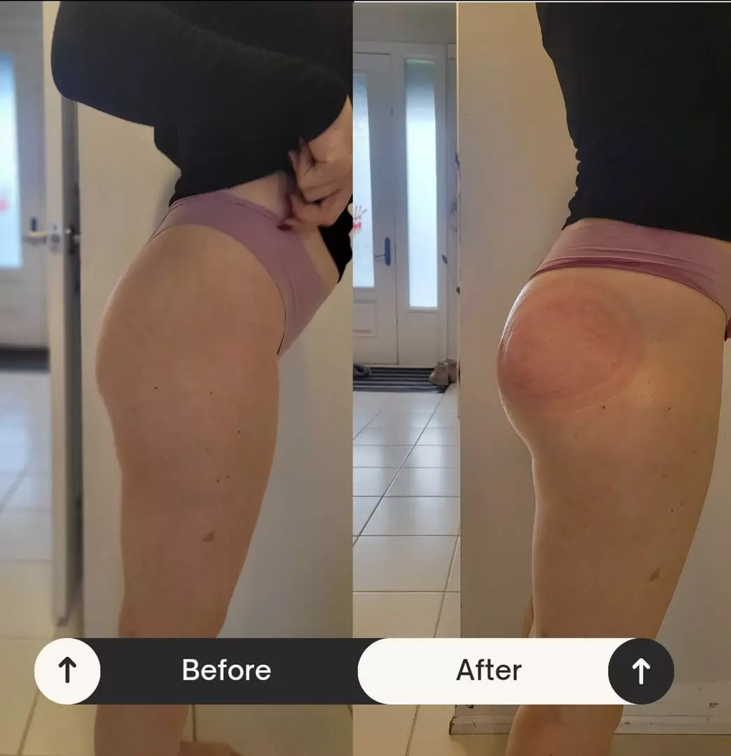 1, 2, or 3 Mini Mommy Make Over with Vacuum Therapy and More