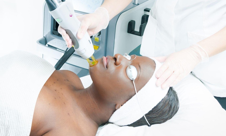 Image 4: Up to 90% Off on Laser Hair Removal at Gentle Zap Laser Med Spa