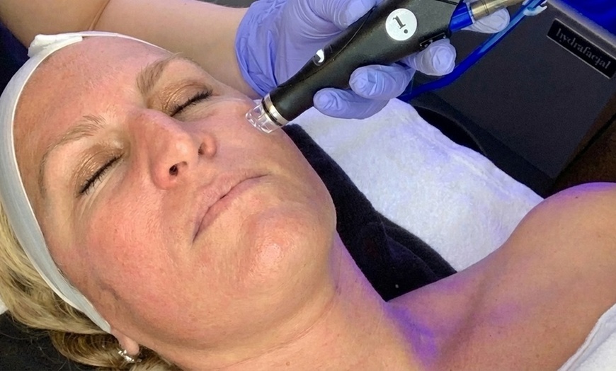 Image 2: Radiant Skin with One, Two or Three 60 Minutes Signature HydraFacial