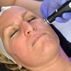 Image 2: Radiant Skin with One, Two or Three 60 Minutes Signature HydraFacial