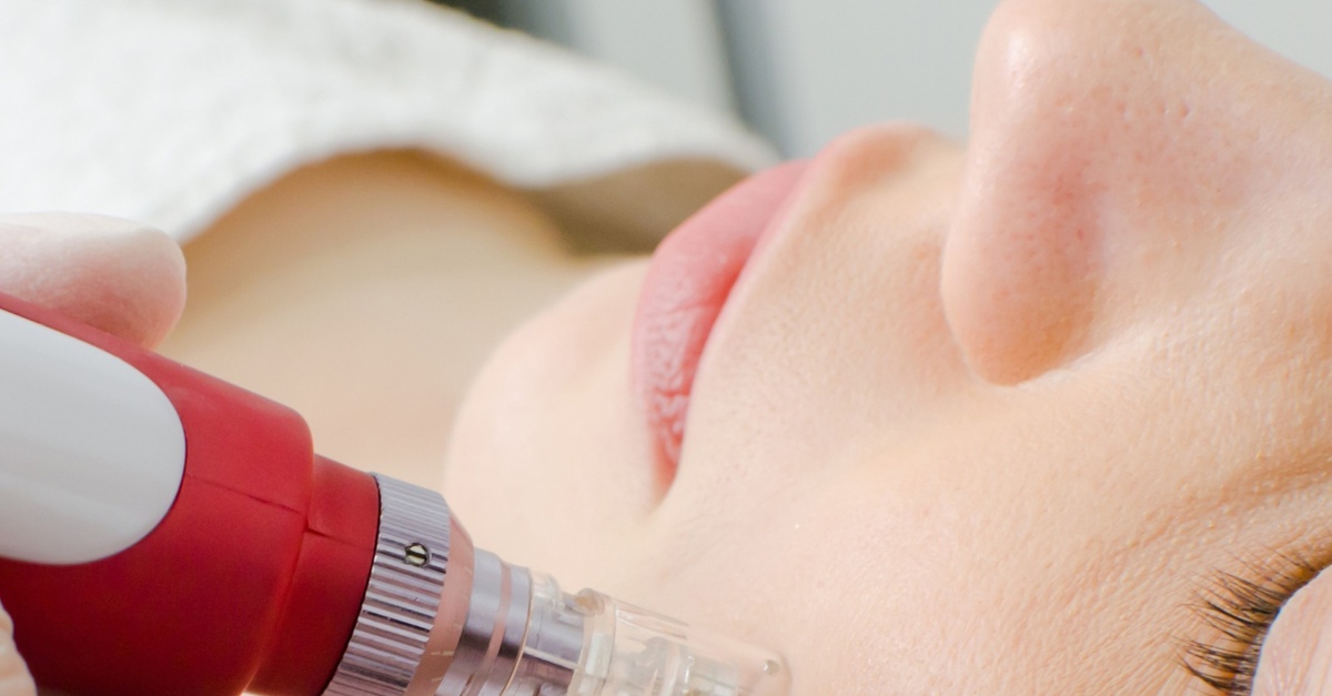 Tratamiento facial meso BB-Glow con Dermapen en Madrid