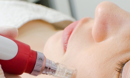 1 sesión de meso BB-Glow a elegir con Dermapen para 1 persona - Susana Gonzalez Dermoestetica