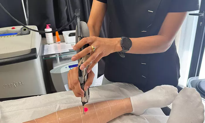 Épilation laser : 3 séances sur une zone au choix avec The French Riviera Studio (jusqu'à 76% de remise) - Primary Image