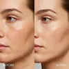 ‍♀️ Face the Glow: Morpheus8 Skin Tightening at Refresh LA — Pick Your Perfect Package