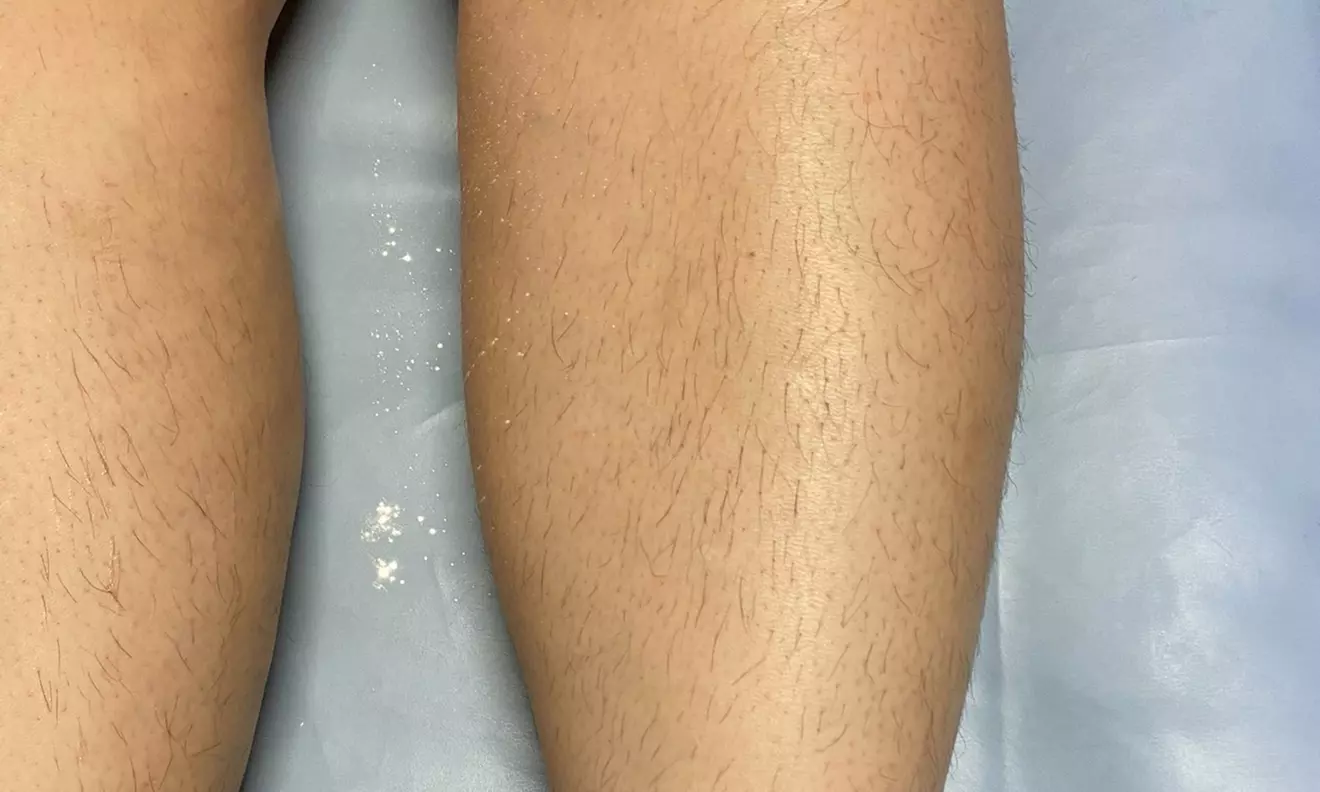 Underarm and Lower Leg Wax or Full Legs, Bikini, and Underarms Wax