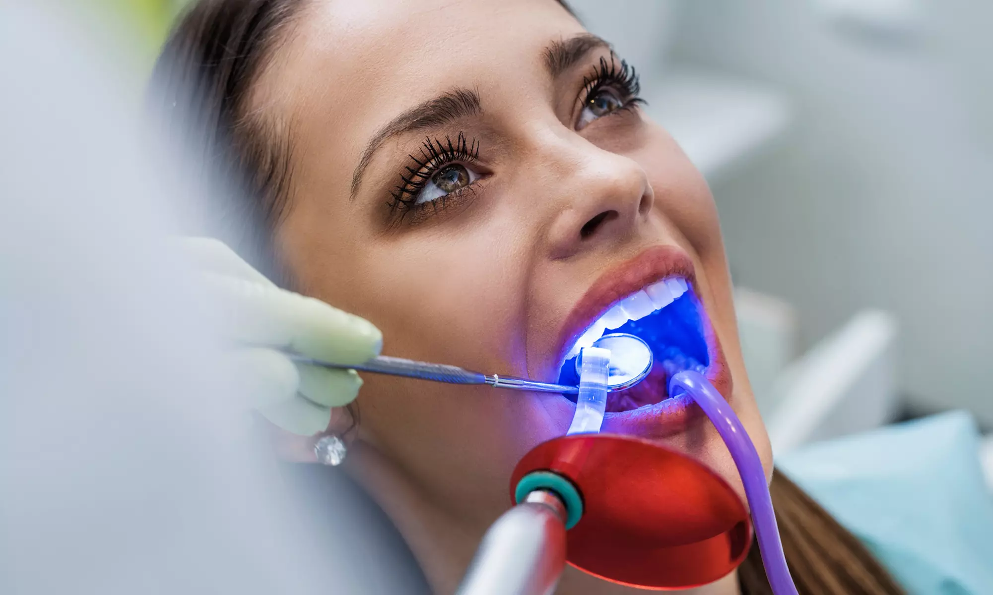 Achieve a Radiant Smile with In-Office Whitening/Cleaning Options