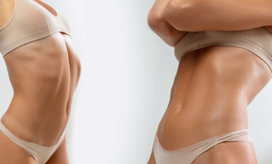 Image 1: Non-Surgical Laser Lipo: 2 Areas