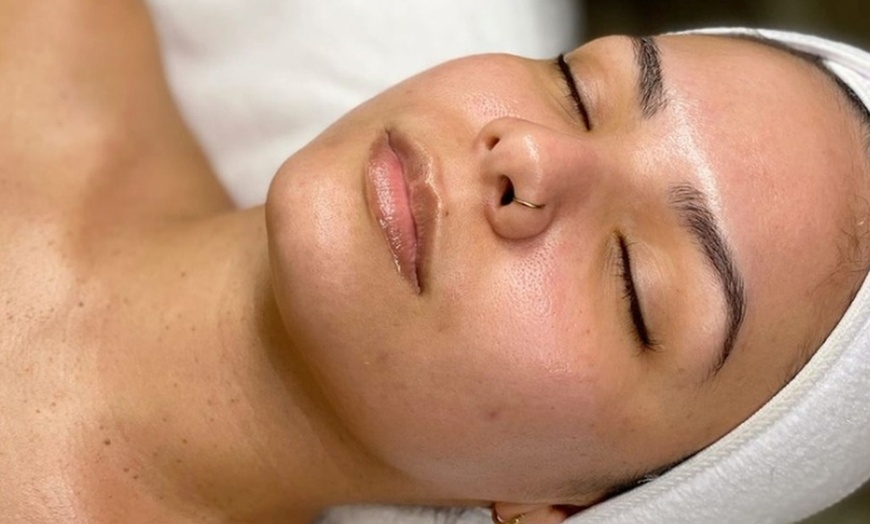 Image 6: Up to 63% Off on Chemical Peel at Allure Passions Aesthetic Clinic