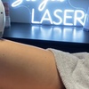 Image 1: Up to 88% Off on Laser Hair Removal at See You Laser
