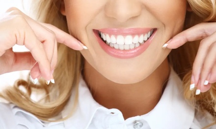 Composite Edge Bonding - 1 Tooth - Veralis