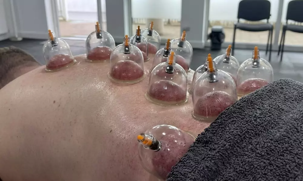 Targeted Relief: One 30-Minutes Acupuncture and / or Cupping Session